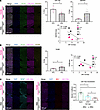 Neuronal miR-133a-3p regulates the levels of pain-relevant mRNA targets in