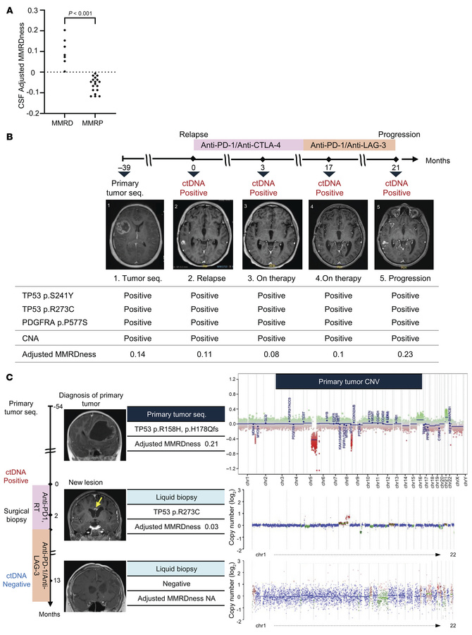 Liquid biopsy in patients with mismatch-repair deficiency.
(A) CSF sampl...