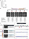 Liquid biopsy in patients with mismatch-repair deficiency.