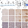 P10 IT administrations of AAV9/SLC13A5 gene therapy in Slc13a5-KO mice resu