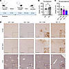 ICM delivery of AAV9/SLC13A5 in adult KO mice results in greater brain NaCT