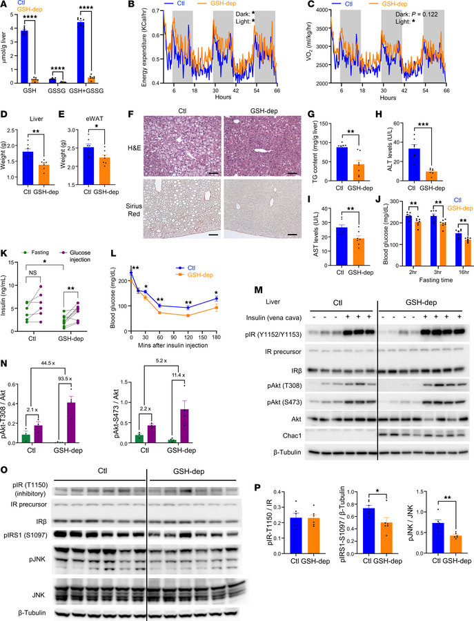 Hepatic GSH depletion protects against HFD-induced MASLD.
(A) Levels of ...