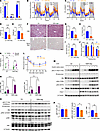 Hepatic GSH depletion protects against HFD-induced MASLD.
