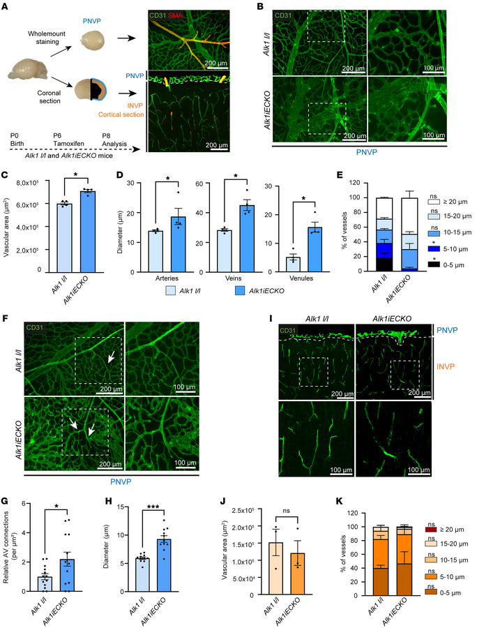 Loss of ALK1 signaling induces vascular malformations in the PNVP.
(A) L...