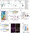 ScRNA-seq reveals distinct EC reprogramming in Alk1iECKO brains.