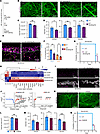Pharmacological KIT inhibition prevents EC proliferation and brain vascular