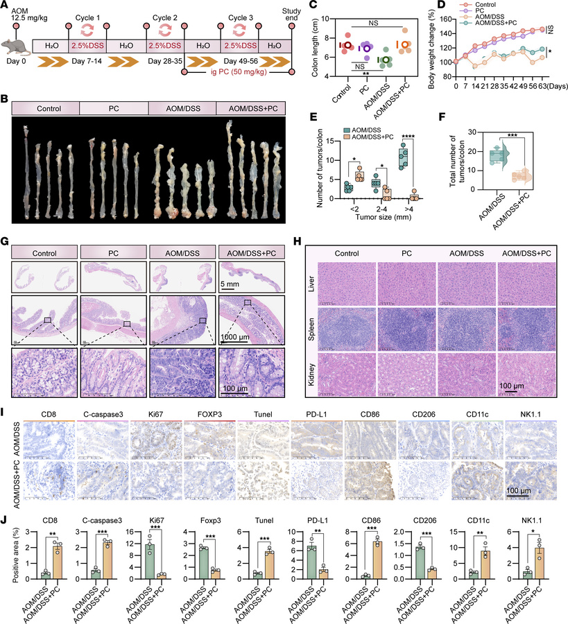 PC demonstrates a significant preventative effect against AOM/DSS-induce...