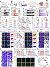 PC enhances T cell killing by downregulating PD-L1.
