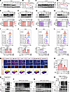 PC promotes K48-linked polyubiquitination of PD-L1 for its degradation.
