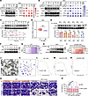 PC targets LKB1 to activate AMPK phosphorylation and downregulate PD-L1.