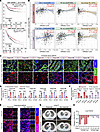 LKB1 and SYVN1 are implicated in cancer therapy and immune regulation.