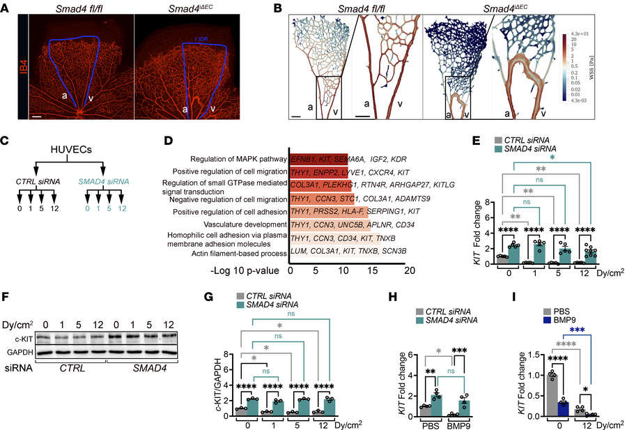 c-KIT upregulation characterizes the high-flow but low-FSS AVMs.
(A and ...