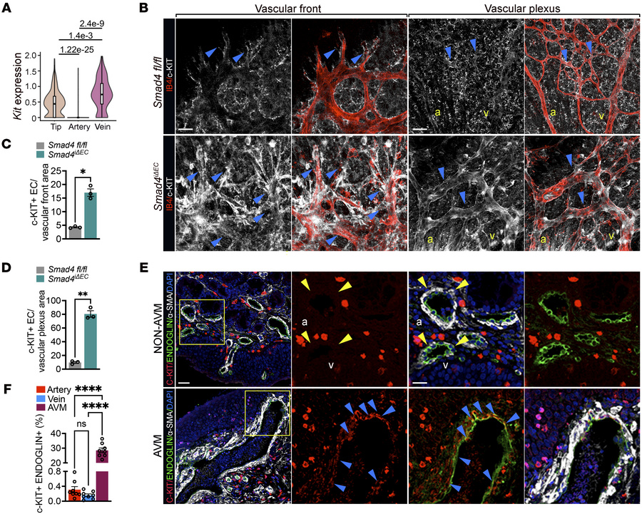 SMAD4 restricts c-KIT expression in vivo.
(A) Reanalysis of Kit expressi...