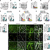 SMAD4 restricts junctional signals upstream of MEKK3/ERK5/KLF4/Akt activati