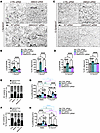 KIT inactivation in SMAD4 KD cells restores the FSS set point for EC behavi
