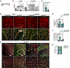 Inhibition of c-KIT kinase activity reverses AVM formation.
