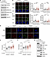 Loss of PTEN leads to uncoupling of helicase and polymerase activities at t