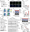 PTEN loss alters CHK1 nuclear localization, compromises cell-cycle checkpoi