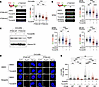 PTEN loss impairs RAD51-mediated fork protection following ATR inhibition.