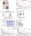PTEN deficiency confers benefit to ATR inhibitor-based treatment in clinica