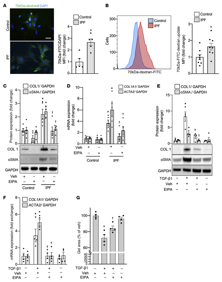 Macropinocytosis is elevated in IPF-derived lung fibroblasts and its inh...