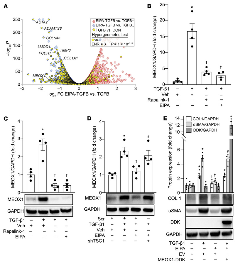 Macropinocytosis inhibition regulates MEOX1 expression in activated lung...