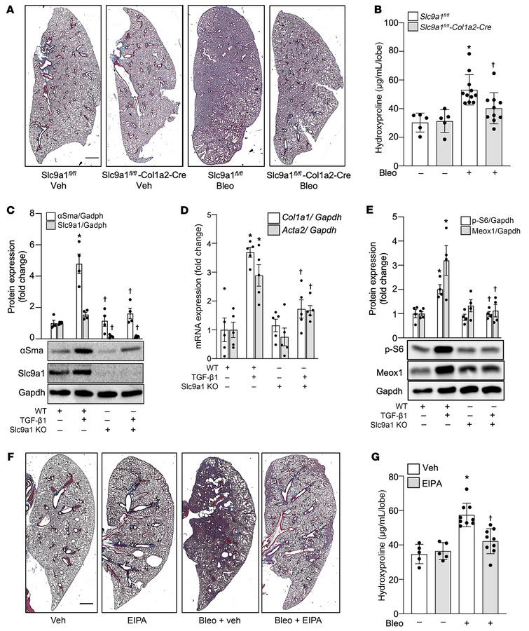 Macropinocytosis inhibition attenuates pulmonary fibrosis in Bleo-injure...