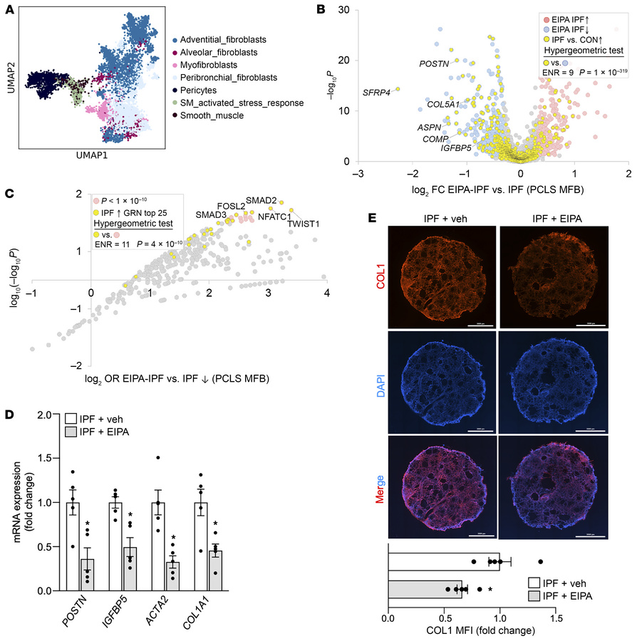 EIPA inhibits profibrotic responses in IPF-derived PCLSs.
IPF-derived PC...