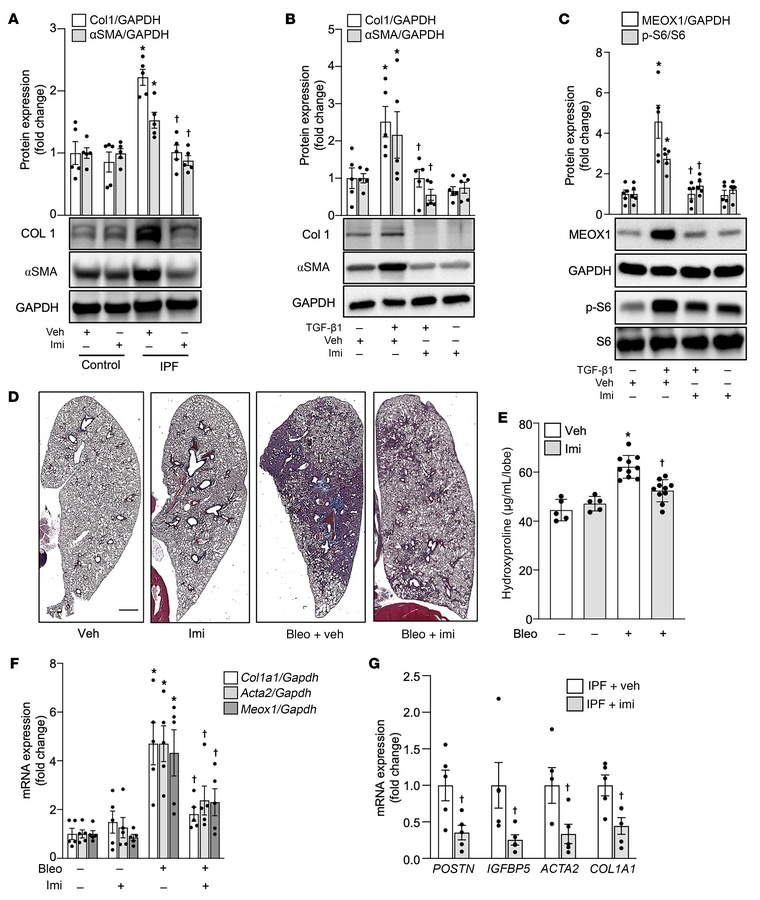 Imipramine ameliorates profibrotic responses in lung fibroblasts, Bleo-i...