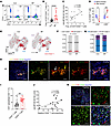 Increased levels of CD20+ T cells in patients with BP.