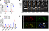 CD20+ T cells exhibit endogenous expression of CD20 in human T cells.
