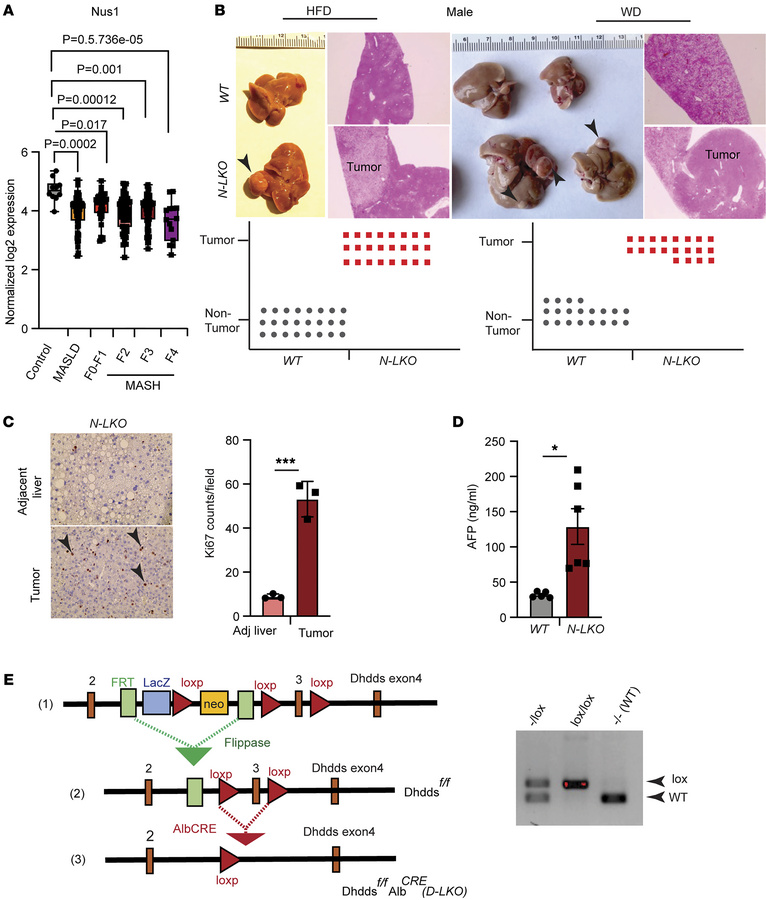 Loss of hepatic NgBR/Dhdds drives HCC development in diet-induced obesit...