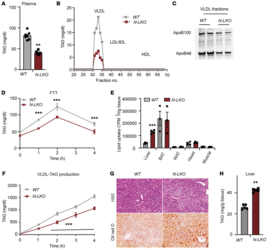 Loss of NgBR function in the liver enhances lipid uptake and impairs VLD...