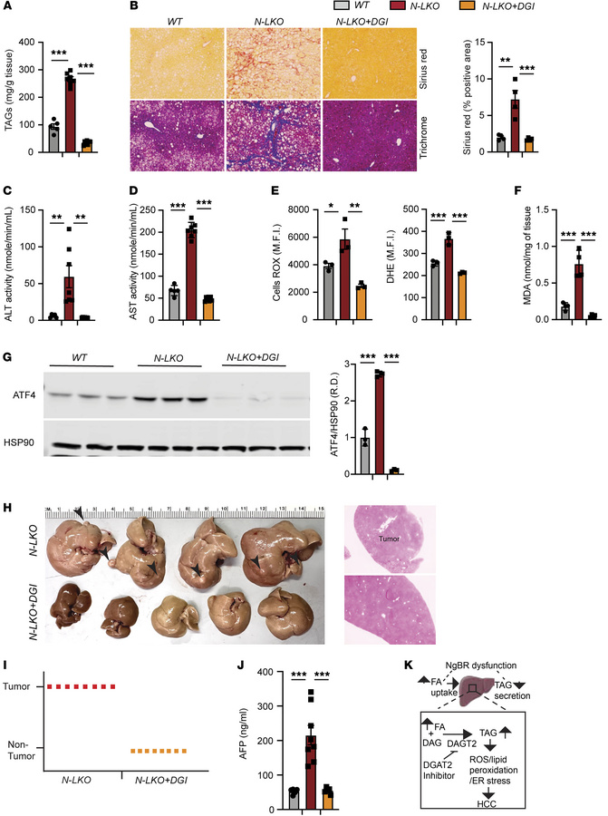 DGAT2 inhibitor treatment prevents diet-induced MASLD-HCC pathogenesis.
...