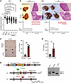 Loss of hepatic NgBR/Dhdds drives HCC development in diet-induced obesity,