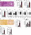 Hepatic NgBR deficiency exacerbates MASH fibrosis phenotype in response to