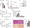 Loss of NgBR function in the liver enhances lipid uptake and impairs VLDL-T