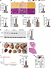 DGAT2 inhibitor treatment prevents diet-induced MASLD-HCC pathogenesis.