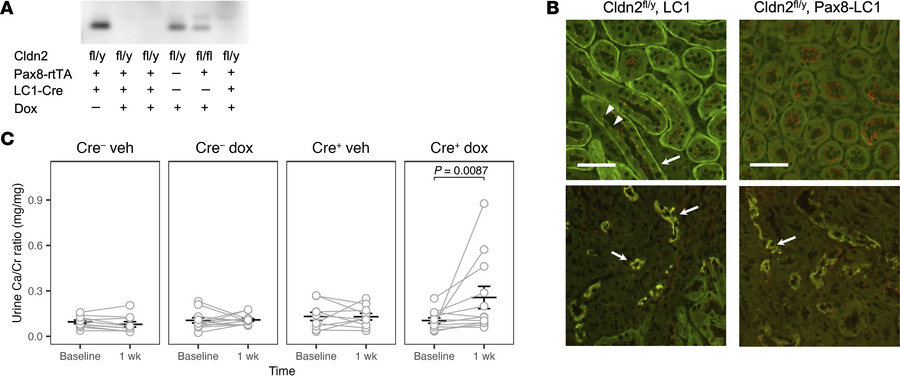 Induction of hypercalciuria within a week in inducible kidney-specific C...