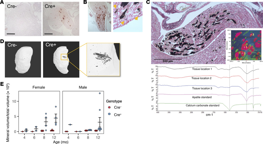 Nephrocalcinosis in older kidney-specific Cldn2-KO mice.
(A) Alizarin re...