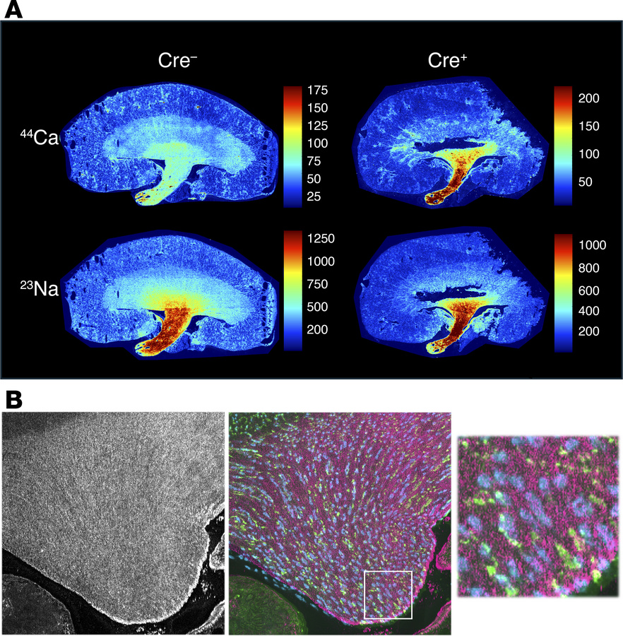 Elemental mapping by LA-ICP MS in 6-week-old mouse kidneys.
(A) 2D maps ...