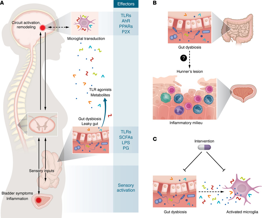 Gut microbiota’s influence on IC symptoms and clinical importance.
(A) V...