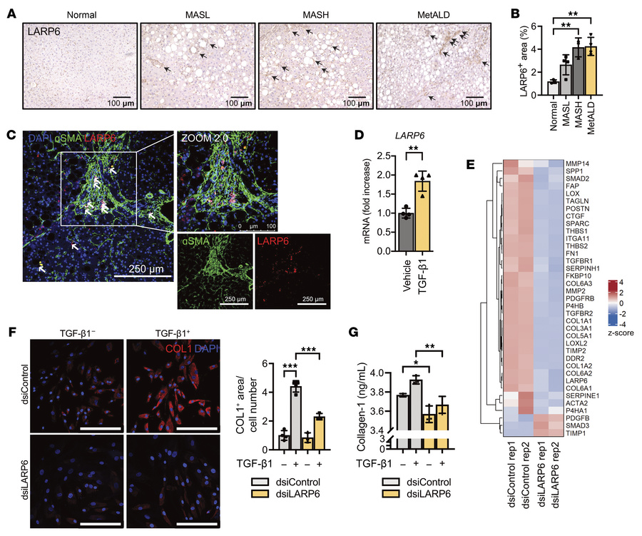 Knockdown of LARP6 inhibits HSC activation.
(A) Human liver tissues were...