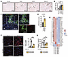 Knockdown of LARP6 inhibits HSC activation.