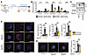 HSC-specific knockdown of LARP6 inhibits MetALD-induced fibrosis in human l
