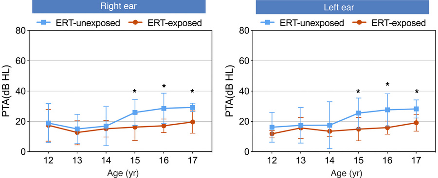 Age-banded hearing thresholds by ERT exposure status.
Bilateral pure-ton...