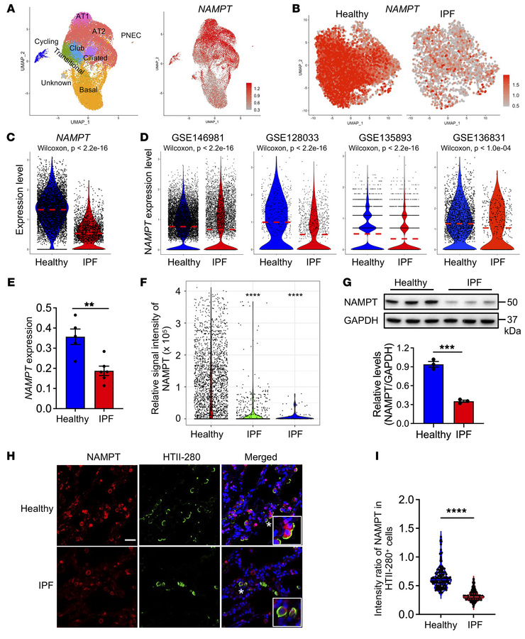 Decreased expression of the NAD+ biosynthesis enzyme NAMPT in IPF AT2 ce...