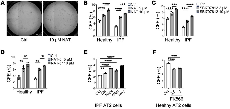 NAMPT regulates AT2 progenitor cell regeneration.
(A) Representative ima...