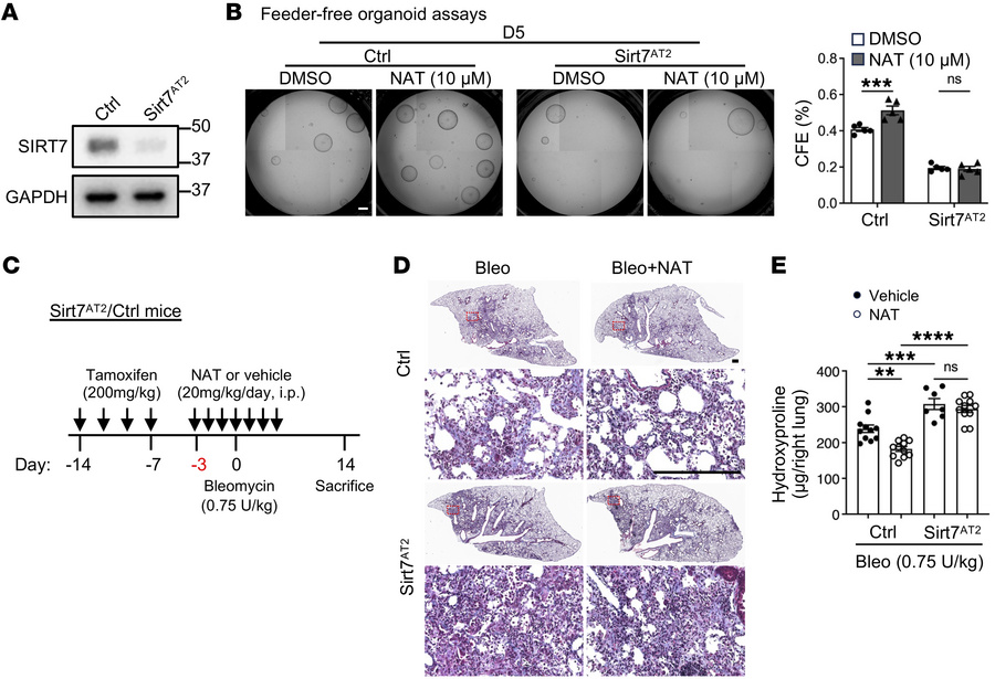 The effects of NAMPT activation on AT2 regeneration and lung fibrosis ar...