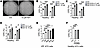NAMPT regulates AT2 progenitor cell regeneration.